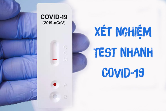 Hướng dẫn tự lấy mẫu và thực hiện test nhanh Covid - 19 tại nhà chi tiết