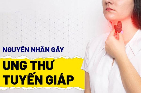 8 dấu hiệu mắc bệnh ung thư tuyến giáp giai đoạn đầu