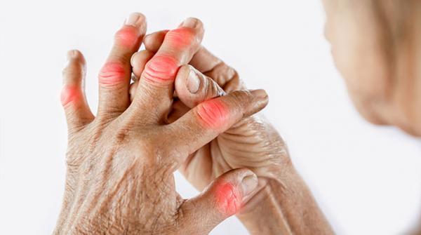 Bệnh Gout: Nguyên nhân, biểu hiện & phương pháp điều trị hiệu quả