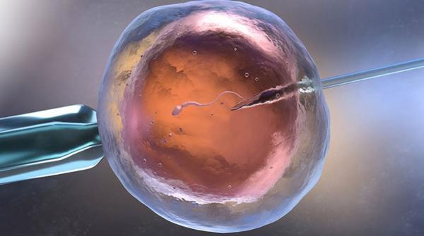 Thụ tinh trong ống nghiệm (IVF) là gì? Quy trình thực hiện IVF