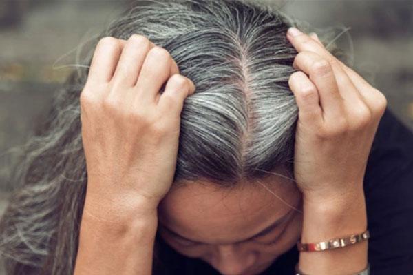 Tóc bạc sớm ảnh hưởng như thế nào đối với sức khỏe?
