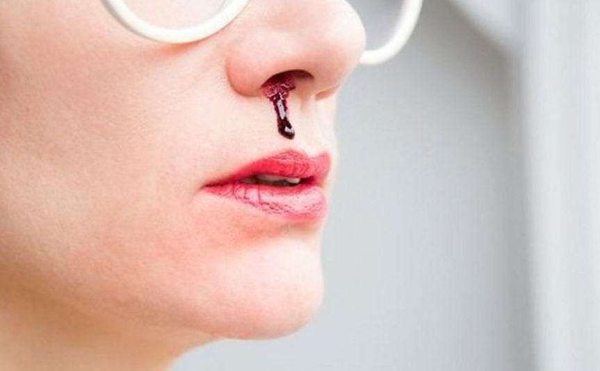 Chảy máu cam hay chảy máu mũi ở người lớn thường xảy ra khi các mạch bên trong mũi bị vỡ và tổn thương