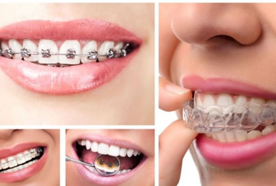 Với mỗi tình trạng răng sẽ có phương pháp cũng như cách điều trị khác nhau