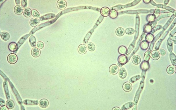Nấm Candida tác nhân chính gây lưỡi trắng