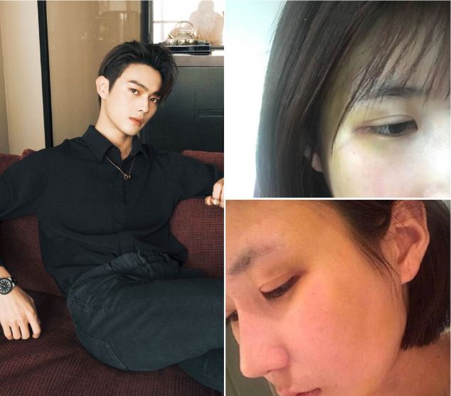 Nam diễn viên từng vướng vào scandal bạo hành bạn gái cũ tên Đại Kim