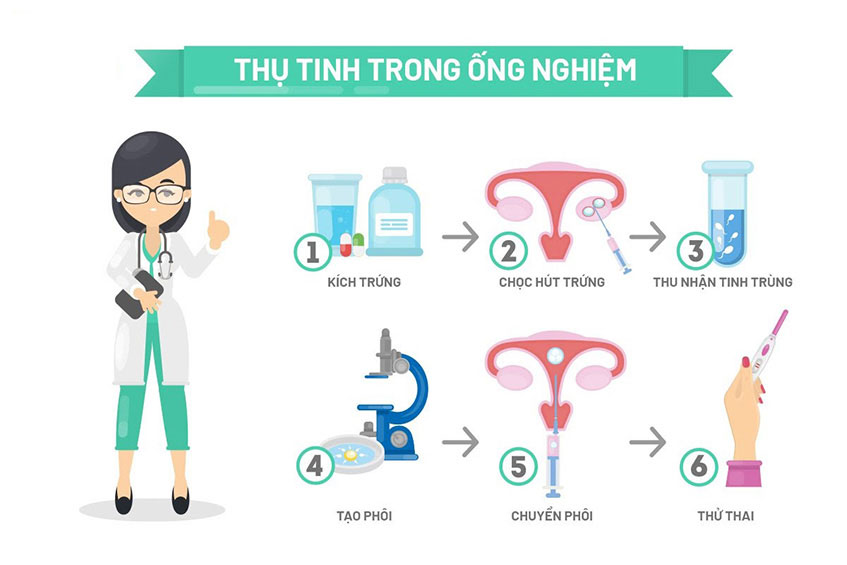 Quy trình thực hiện IVF