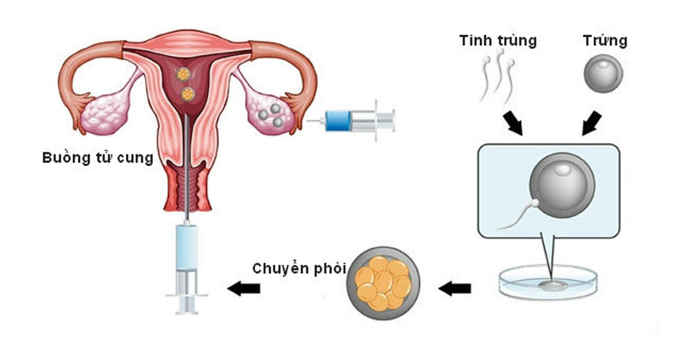Những lưu ý quan trọng