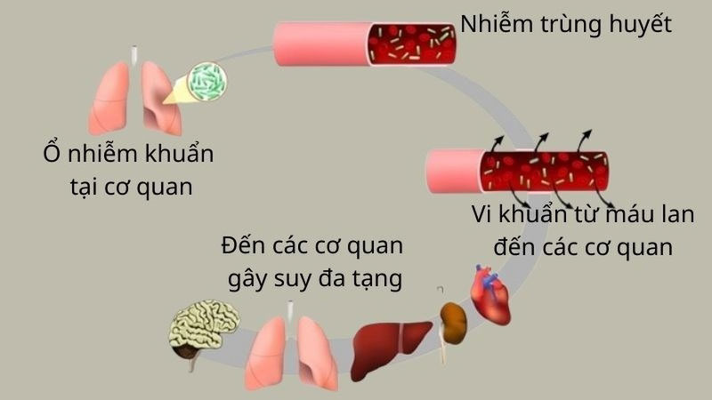 Các vi sinh vật phổ biến gây nhiễm khuẩn huyết