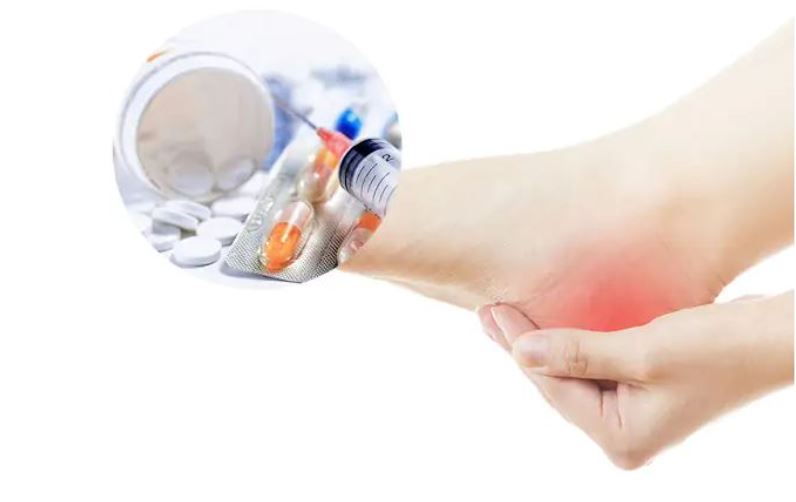 Biểu hiện đặc trưng của gout