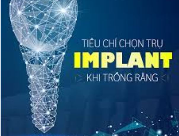 5 tiêu chí chọn trụ răng Implant phù hợp