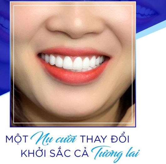 Răng cửa đẹp sẽ giúp bạn tự tin và hài lòng về bộ răng hơn