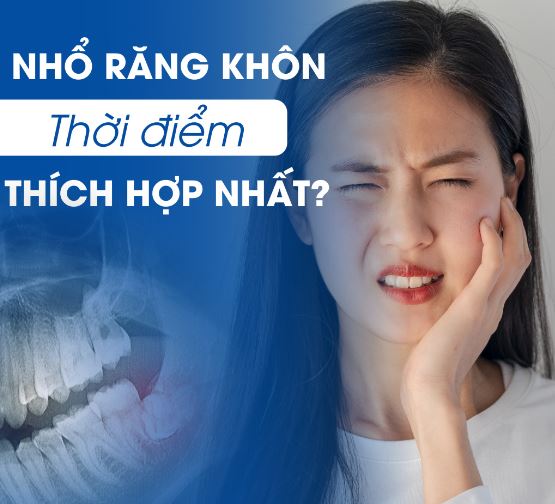 Thời điểm thích hợp nhất để nhổ răng khôn từ 18 đến 25 tuổi